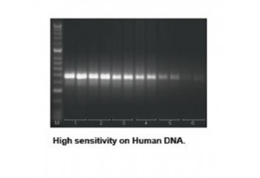 Tetro cDNA Synthesis Kit - Công Ty Cổ Phần Công Nghệ TBR